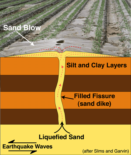 Dissection of Sand Blow